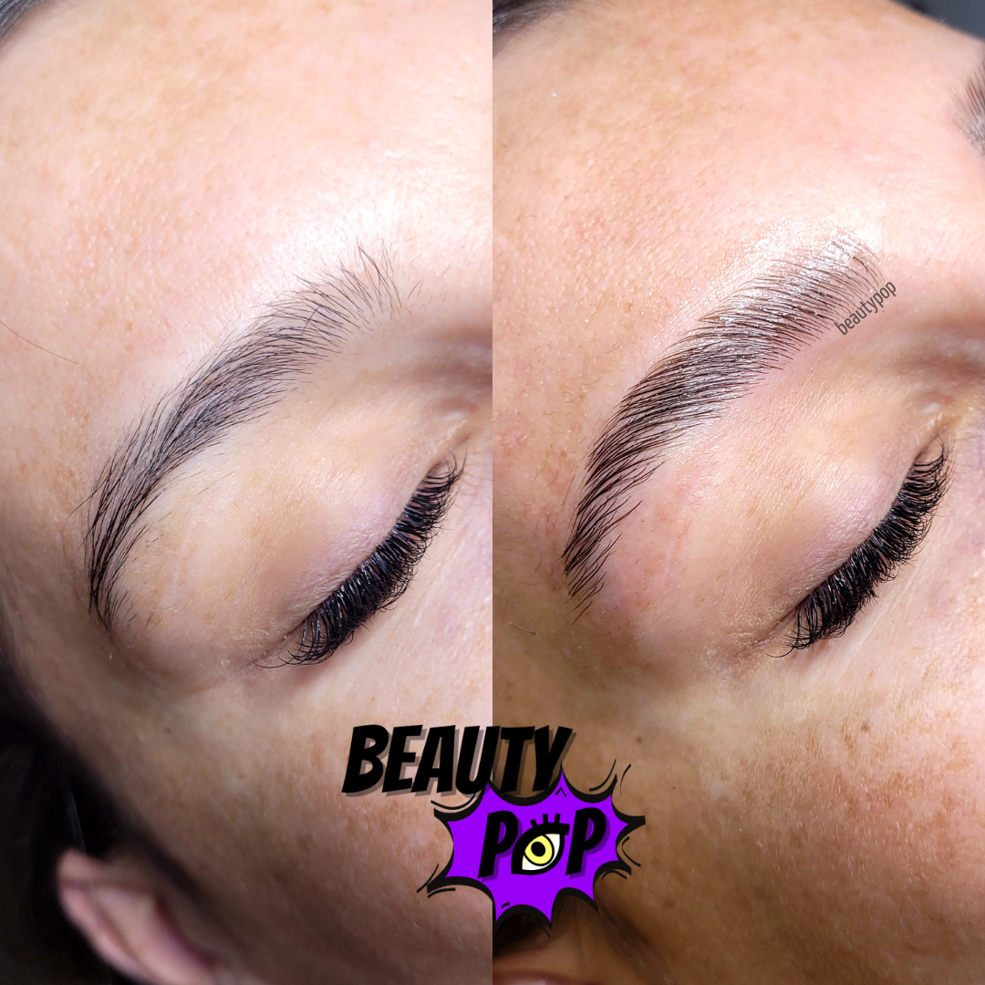 Formation Browlift